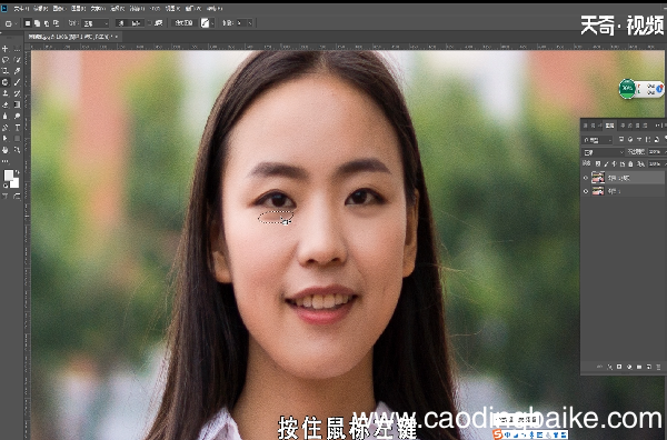 如何去眼袋